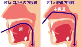 イメージ図