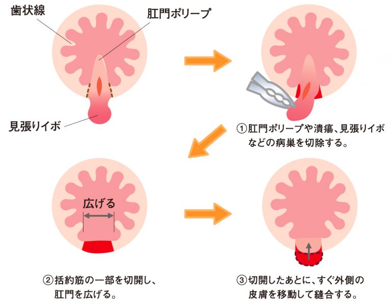 肛門外科 世田谷区三軒茶屋 西太子堂で肛門科の井上外科 内科